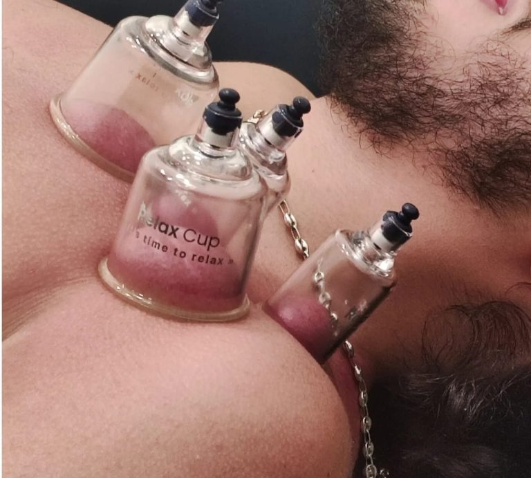 personne qui fait une séance de cupping thérapie