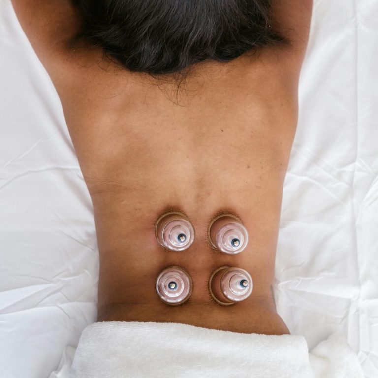 Cupping thérapie sur le dos